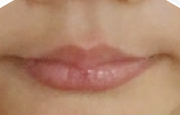 Bibir dan mulut seorang kanak-kanak