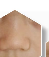 Sebuah hidung