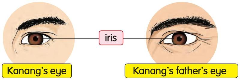 Kanang's eye and his father's eye with the same iris colour