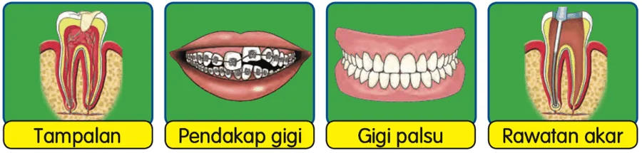 Tampalan, pendakap gigi, gigi palsu dan rawatan akar