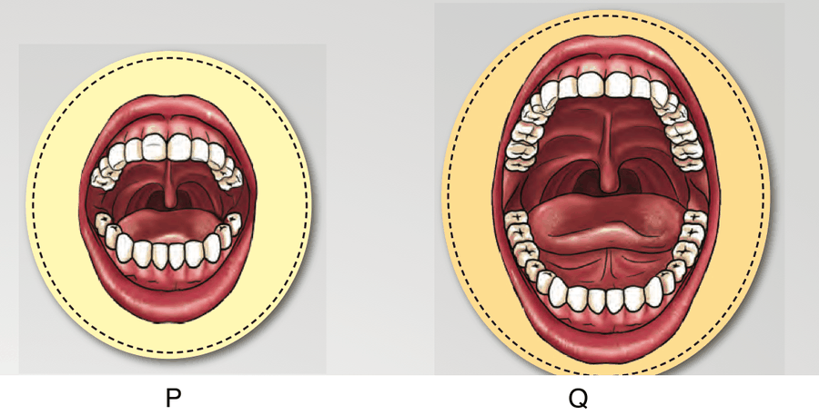 P: a small mouth with fewer teeth. Q: a bigger mouth with more teeth