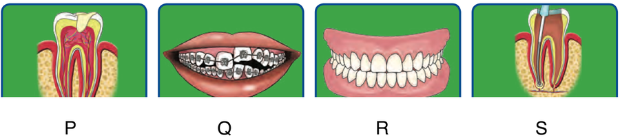 Four pictures: a tooth with a filling, teeth with braces, false teeth, and a tooth having root canal treatment