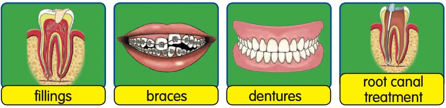 Fillings, braces, dentures and root canal treatment