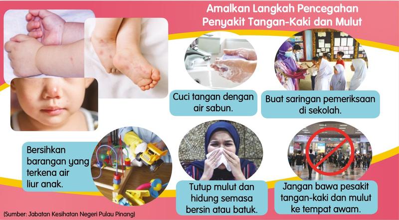 Brosur langkah pencegahan penyakit tangan-kaki dan mulut dengan lima langkah
