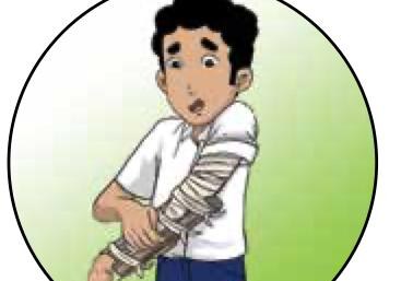 A boy with a bandaged arm who cannot bend it