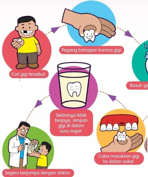 Poster langkah menyelamatkan gigi kekal yang tercabut