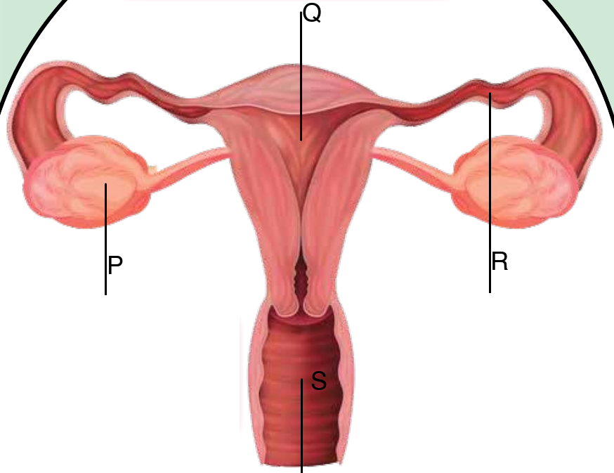 Female reproductive organs with P on an ovary, Q on the uterus, R on a Fallopian tube and S on the vagina