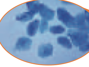 Cheek cells under a microscope: rounded blue cells