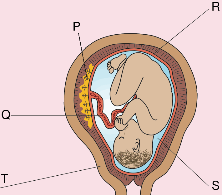 Foetus in the uterus with structures labelled P, Q, R, S and T
