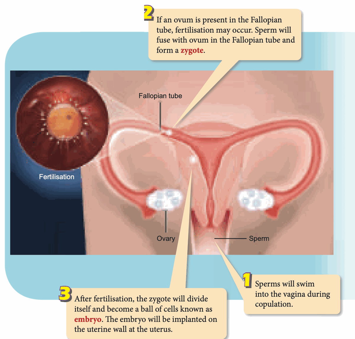 Diagram of the female reproductive system showing where sperm enter, fertilisation in the Fallopian tube, and implantation