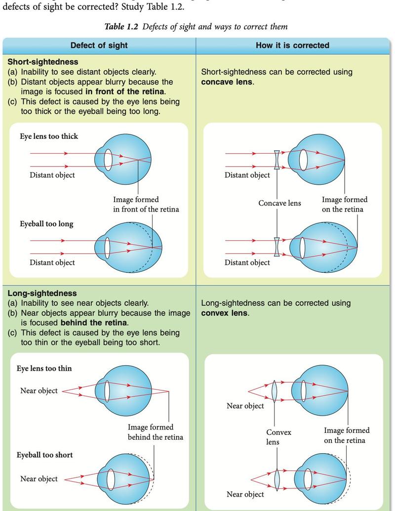 Short-sightedness and long-sightedness and how they are corrected with lenses