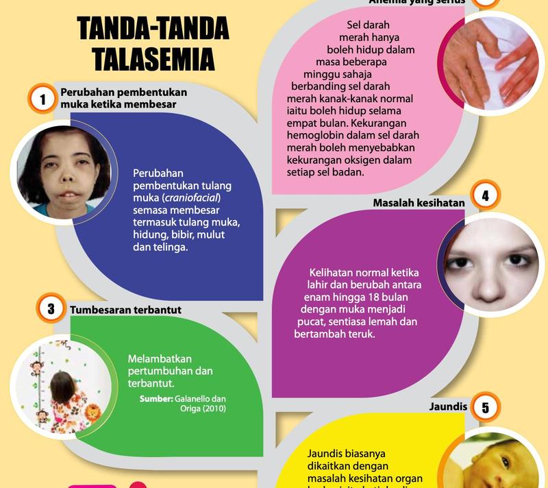 Lima tanda talasemia: perubahan tulang muka, anemia serius, tumbesaran terbantut, muka pucat dan lemah, jaundis