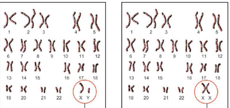 Kariotip lelaki (44 + XY) dan kariotip perempuan (44 + XX), kromosom seks dibulatkan
