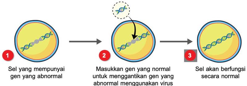 Tiga langkah terapi gen: sel dengan gen abnormal, gen normal dimasukkan menggunakan virus, sel berfungsi secara normal