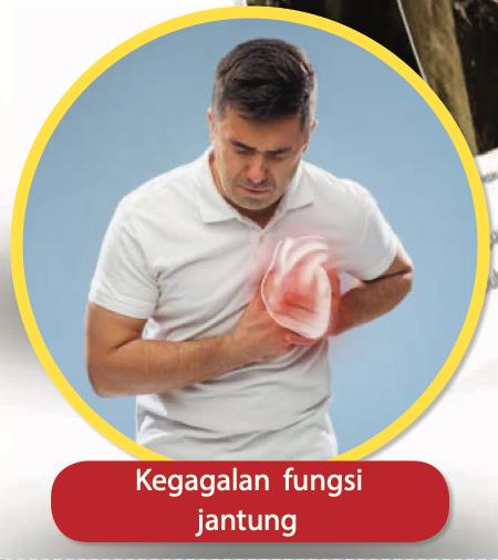 Seorang lelaki memegang dadanya kerana sakit jantung